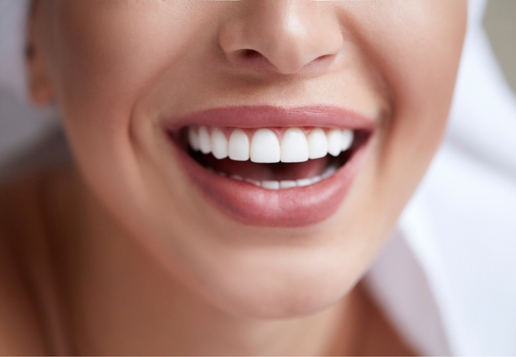 The Seamless Process of Transforming Smiles with Dental Veneers in Burlington