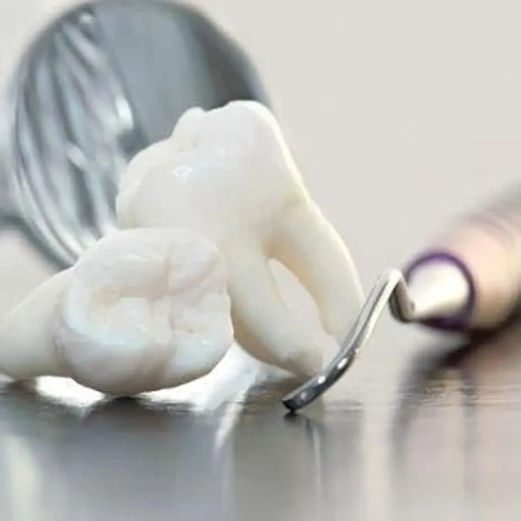 Embrace the Benefits of Wisdom Tooth Removal